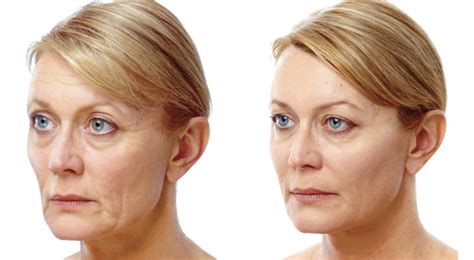 888 biscayne blvd|Nuyou Medical Aesthetics.